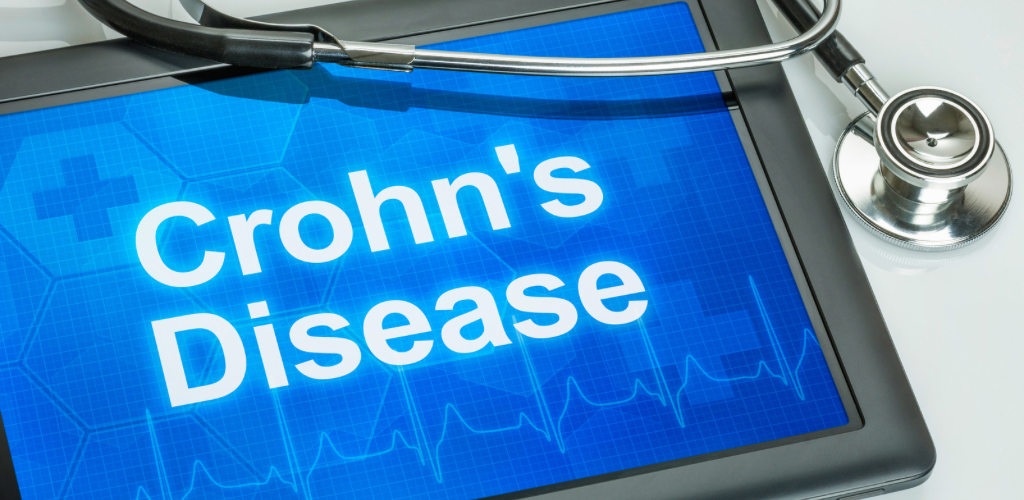 Read more about the article How to become CROHN’S DISEASE free by Allopathic Remedies