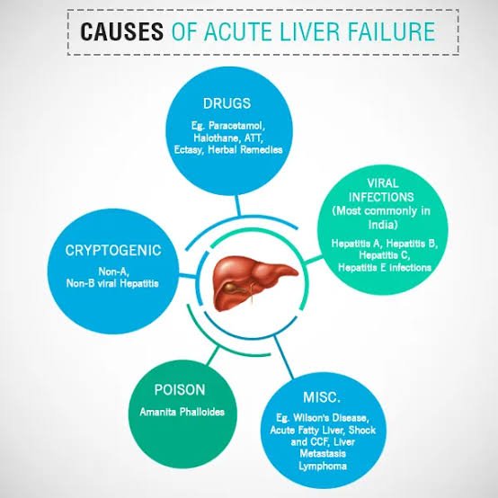 Read more about the article How to know about ACUTE LIVER FAILURE